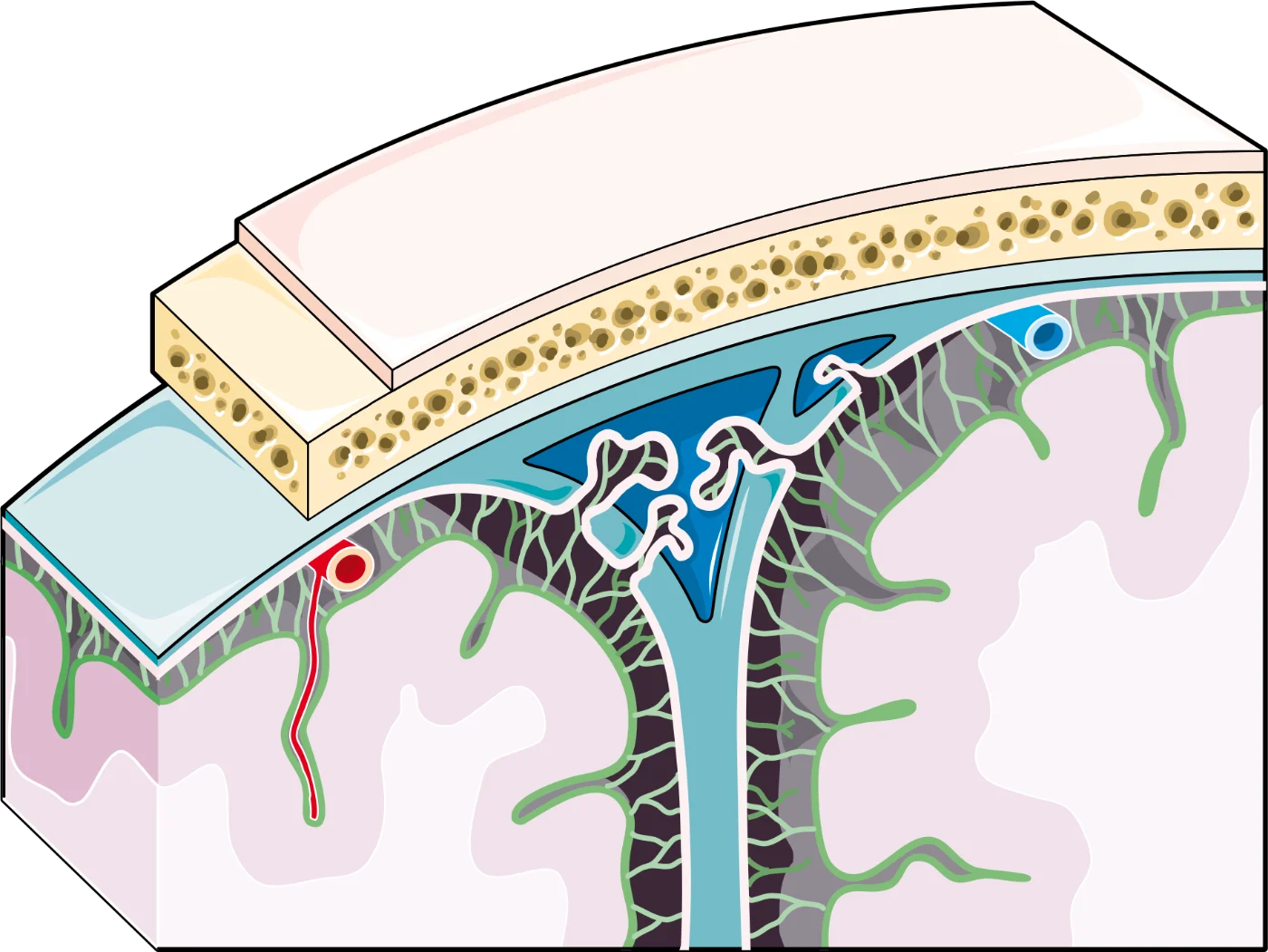 Block aus Kopfhaut, Schädel, Dura mit Sinus und Falx, Arachnoidea, Subarachnoidalraum, Pia und Rinde / block of scalp, skull, dura with sinus and falx, arachnoid, subarachnoid space, pia and cortex